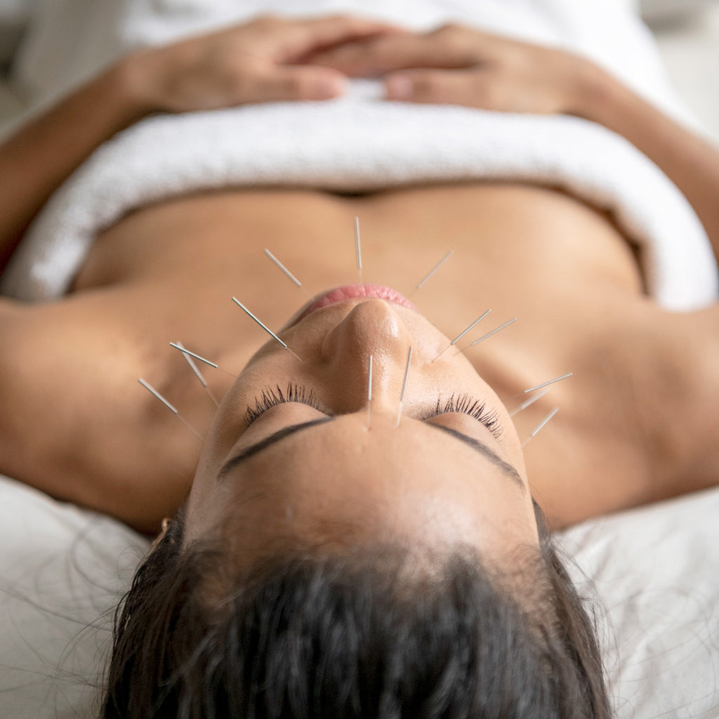Acupuncture | Soho Acupuncture Center NYC