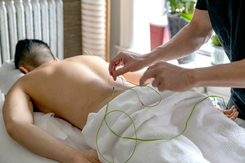 Guide to Healing with Acupuncture | Soho Acupuncture Center NYC